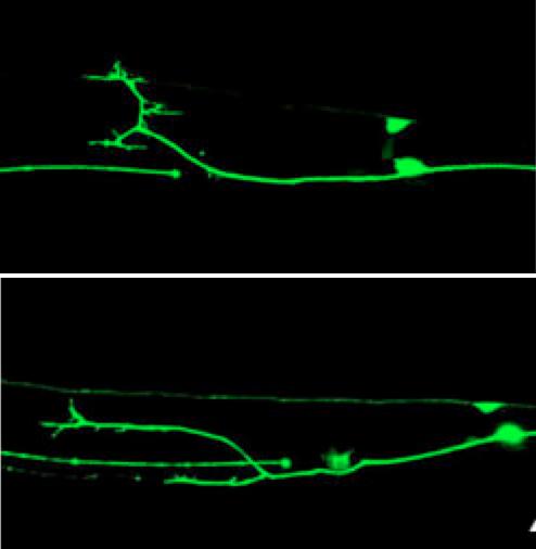 Genes Discovered That Repair Neurons