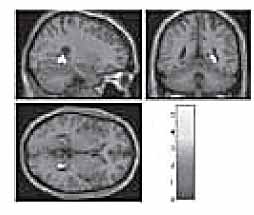 In Search Of 'the Telepathy Center'